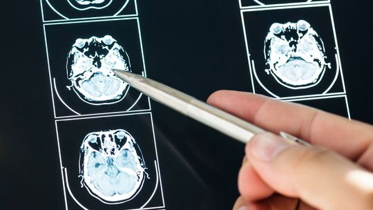 Co warto wiedzieć przed pierwszą wizytą u neurologa?