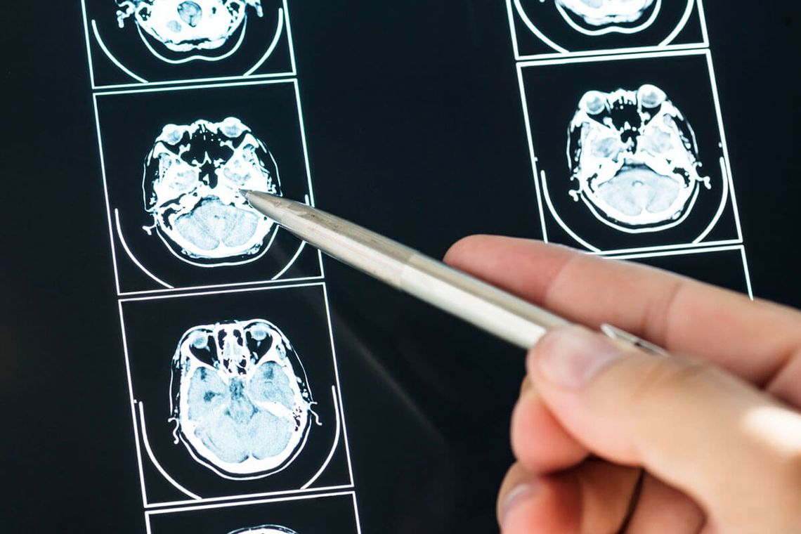 Co warto wiedzieć przed pierwszą wizytą u neurologa?